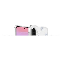 Onegif Samsung Galaxy A37 5g Misk Simli Magsafe Kapak - Desen 3 - Desen 3