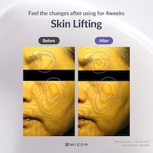 Mizon Hyalugen Le Lift Kremi 50ml