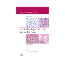 Karaciğer Biyopsilerinin Yorumlanması - Biyopsi Yorumları Serisi