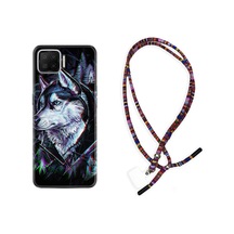 Oppo A73 Kılıf Rasta Boyun Askılı Dog Eyes 1761 Siyah