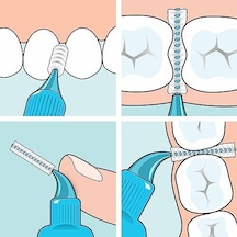Blister X-soft 0.6 Mm Mor Diş Arayüz Fırçası 1 X 6 Adet Açık Ahşap