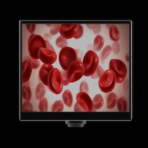 Yw5612 11.6 İnç Hepsi Bir Arada Mikroskop Kamerası - 5mp 1080p 60fps Hdmı & Usb Entegre Monitörlü Dijital Mikroskop Ekranı