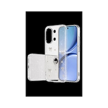 Newface Poco X8 Pro Max Fiyonk Desenli Kapak - Desen 5