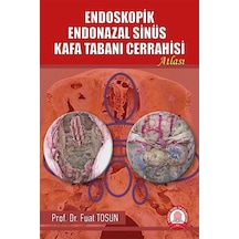 Endoskopik Endonazal Sinüs Kafa Tabanı Cerrahisi