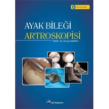 Ayak Bileği Artroskopisi