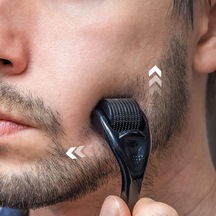Dermoroller 540 Mikro İğneli 0.5mm - Cilt Ve Saç Bakımı İçin Dermaroller - Yüz, Saç Derisi, Cilt Yenileme Ve Gözenek Sıkılaştırma - Mikro İğne Terapisi - Kolay Kullanım Ve Etkili Sonuçlar