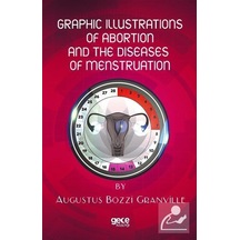 Graphic Illustrations of Abortion and the Diseases of Menstruation - Augustus Bozzi Granville - Gece Kitaplığı