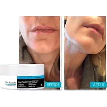 Bezos Süper Dr Botokss Cildinizin Yeniden Yapılanması Için Giderci Bakım Kremi 50 Ml X 2 Adet Hb006