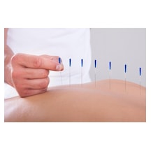 Medikaltec Akupunktur Iğnesikuru Iğne,acupuncture Needle 0.30 60mm