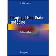 Imagıng of fetal Brain and Spine