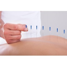 Medikaltec Akupunktur Iğnesikuru Iğne,acupuncture Needle 0.25 25mm