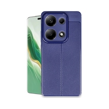 Newface - 587 - Xiaomi Redmi Note 13 Pro 4g Kılıf Auto Focus Kapak - Novapazr - - Lacivert