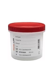 Patoloji Numunesi Kabı 500 Ml Spesmen Kabı 0.5 Lt Beyaz