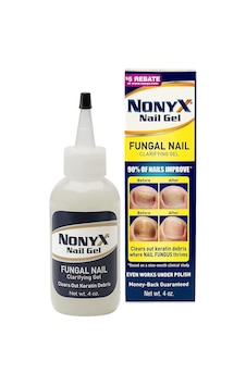 Nonyx Nail Gel 113 G
