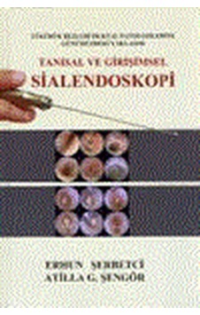 Tanısal Ve Girişimsel Sialendoskopi- Nobel Tıp Kitabevleri Tanısal Ve Girişimsel Sialendoskopi- Nobel Tıp Kitabevleri