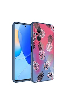 Zore Huawei Nova 9 Se Kılıf Kamera Korumalı Desenli Sert Silikon Ogaa Epoksi Kapak - No3 Zore Huawei Nova 9 Se Kılıf Kamera Korumalı Desenli Sert Silikon Ogaa Epoksi Kapak - No3