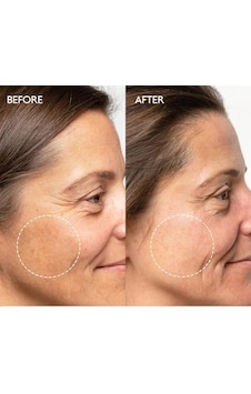 Beyazlatıcı Etkili Leke Karşıtı Bakım Kremi Arbutin Yüzde İki Brightening Krem 50ml Beyazlatıcı Etkili Leke Karşıtı Bakım Kremi Arbutin Yüzde İki Brightening Krem 50ml