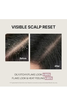 Simplyo Saç Derisi Ve Saç Bakımı Için Doğal Çözüm Refreshing Scalp Shampoo Flower, Kore'den Ithal Simplyo Saç Derisi Ve Saç Bakımı Için Doğal Çözüm Refreshing Scalp Shampoo Flower, Kore'den Ithal