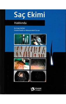 Saç Ekimi Hakkında