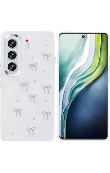 Teleplus Tecno Camon 40 Pro 5g Kılıf Kutup Desenli Simli Kapak Teleplus Tecno Camon 40 Pro 5g Kılıf Kutup Desenli Simli Kapak