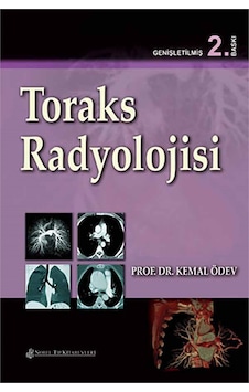 Toraks Radyolojisi- Nobel Tıp Kitabevleri Toraks Radyolojisi- Nobel Tıp Kitabevleri