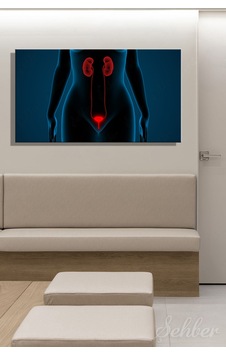 İnsan İdrar Sistemi Böbrekler Ve Mesane Anatomisi 3d İllüstrasyon Yatay Kanvas Tablo Tekli 3556