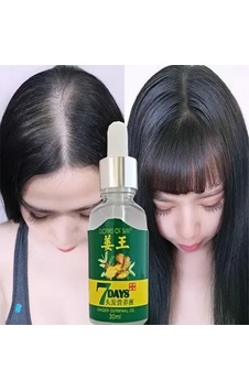 Sh 7days 30ml Gingergerminalessentialoil Hair Growth Loss Treatment Serum Unisex 3 Adet Saç Bakım Yağı Najmaddin Sh 7days 30ml Gingergerminalessentialoil Hair Growth Loss Treatment Serum Unisex 3 Adet Saç Bakım Yağı Najmaddin