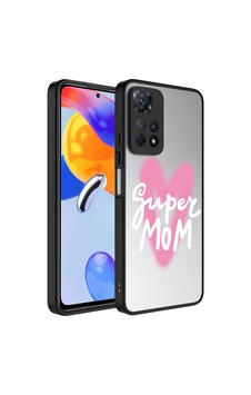 Xiaomi Redmi Note 11 Pro 5g Kılıf Aynalı Desenli Kamera Korumalı Parlak Zore Mirror Kapak Süper Anne Xiaomi Redmi Note 11 Pro 5g Kılıf Aynalı Desenli Kamera Korumalı Parlak Zore Mirror Kapak Süper Anne