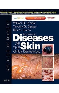 Andrew's Diseases Skin Andrew's Diseases Skin