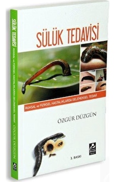 Sülük Tedavisi - Özgür Düzgün Sülük Tedavisi - Özgür Düzgün