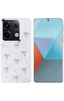 Noktaks - Xiaomi Uyumlu Xiaomi Redmi Note 13 Pro 4g - Kılıf Airbag Tasarımlı Simli Şeffaf Koruyucu Kutup Kapak - Fiyonk T36308 Fiyonk Noktaks - Xiaomi Uyumlu Xiaomi Redmi Note 13 Pro 4g - Kılıf Airbag Tasarımlı Simli Şeffaf Koruyucu Kutup Kapak - Fiyonk T36308 Fiyonk