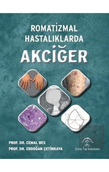 Romatizmal Hastalıklarda Akciğer - Erdoğan Çetinkaya - Cemal Bes - Ema Tıp Kitabevi Romatizmal Hastalıklarda Akciğer - Erdoğan Çetinkaya - Cemal Bes - Ema Tıp Kitabevi