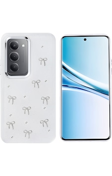 Xiaomi Redmi 15 Kılıf Airbag Tasarımlı Simli Şeffaf Kapak Kutup Fiyonk Xiaomi Redmi 15 Kılıf Airbag Tasarımlı Simli Şeffaf Kapak Kutup Fiyonk