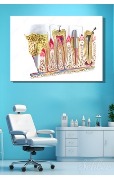 Diş Patolojileri, Kesitsel Bir Diş Ve Çene Anatomisi Eğitim Modeli Yatay Kanvas Tablo 4736 Çok Renkli Diş Patolojileri, Kesitsel Bir Diş Ve Çene Anatomisi Eğitim Modeli Yatay Kanvas Tablo 4736 Çok Renkli