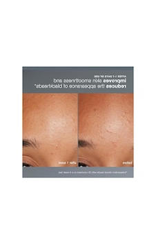 Günlük Mikrofolyant 13g, Cilt Yenileyici Peeling Günlük Mikrofolyant 13g, Cilt Yenileyici Peeling