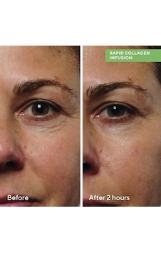 Murad Collagen Infusion Anında Sıkılaştırıcı Kolajen Serumu 30 Ml Murad Collagen Infusion Anında Sıkılaştırıcı Kolajen Serumu 30 Ml
