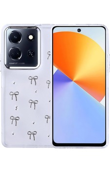 Nihcase İnfinix Note 30 5g Kılıf Kutup Simli Glitter Fiyonk Desenli Kapak Nihcase İnfinix Note 30 5g Kılıf Kutup Simli Glitter Fiyonk Desenli Kapak