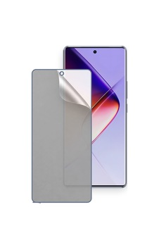 Infinix Note 40s Uyumlu Ön Yüzey Mat Hidrojel Ekran Koruyucu Infinix Note 40s Uyumlu Ön Yüzey Mat Hidrojel Ekran Koruyucu