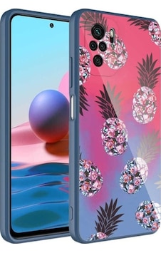 Xiaomi Redmi Note 10 Kılıf Kamera Korumalı Desenli Sert Silikon Zore Epoksi Kapak NO3