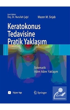 Keratokonus Tedavisine Pratik Yaklaşım - Mazen M. Sinjab Keratokonus Tedavisine Pratik Yaklaşım - Mazen M. Sinjab