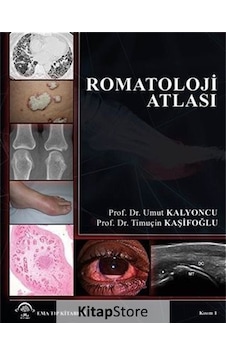 Romatoloji Atlası - Kısım 1 - Timuçin Kaşifoğlu - Ema Tıp Kitabevi Romatoloji Atlası - Kısım 1 - Timuçin Kaşifoğlu - Ema Tıp Kitabevi
