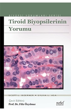 Tiroid Biyopsilerinin Yorumu - Biyopsi Yorumları Serisi N11.509