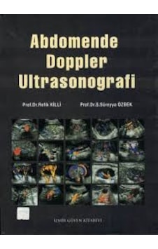 Abdomende Doppler Ultrasonografi