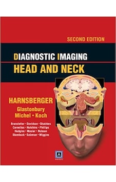 Diagnostic Imaging Head and Neck Hardcover – December 15, 2010