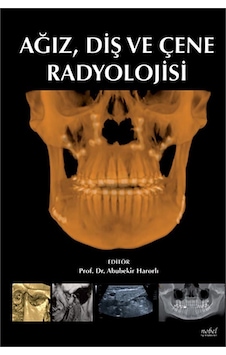 Ağız Diş Ve Çene Radyolojisi- Nobel Tıp Kitabevleri