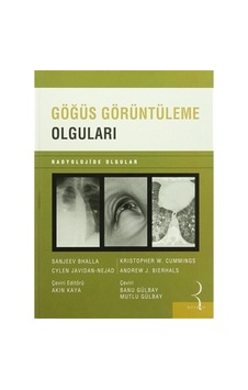 Göğüs Görüntüleme Olguları Göğüs Görüntüleme Olguları