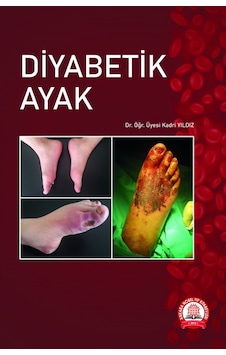 Diyabetik Ayak
