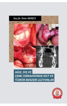 Ağız Diş Ve Çene Cerrahisinde Kist Ve Tümör Benzeri Lezyonlar Ağız Diş Ve Çene Cerrahisinde Kist Ve Tümör Benzeri Lezyonlar