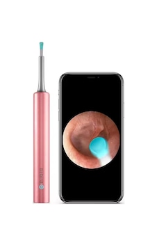 Bebırd T5 3mp Kamera 3.5mm Lens Şarjlı Wıfı Görüntülü Kulak Temizleyici Pembe Renk