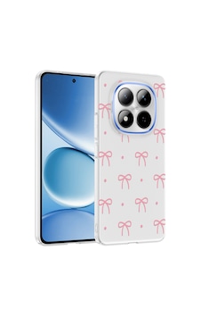 Teleplus Xiaomi Redmi Note 15 Pro 4g Kılıf Klipx Serisi Mat Desenli Tpu Kapak Teleplus Xiaomi Redmi Note 15 Pro 4g Kılıf Klipx Serisi Mat Desenli Tpu Kapak